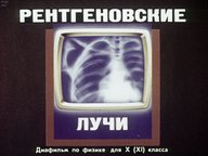 Диафильм «Рентгеновские лучи»